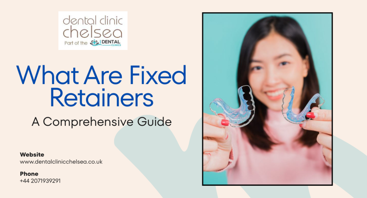 Fixed Retainer Cost in London